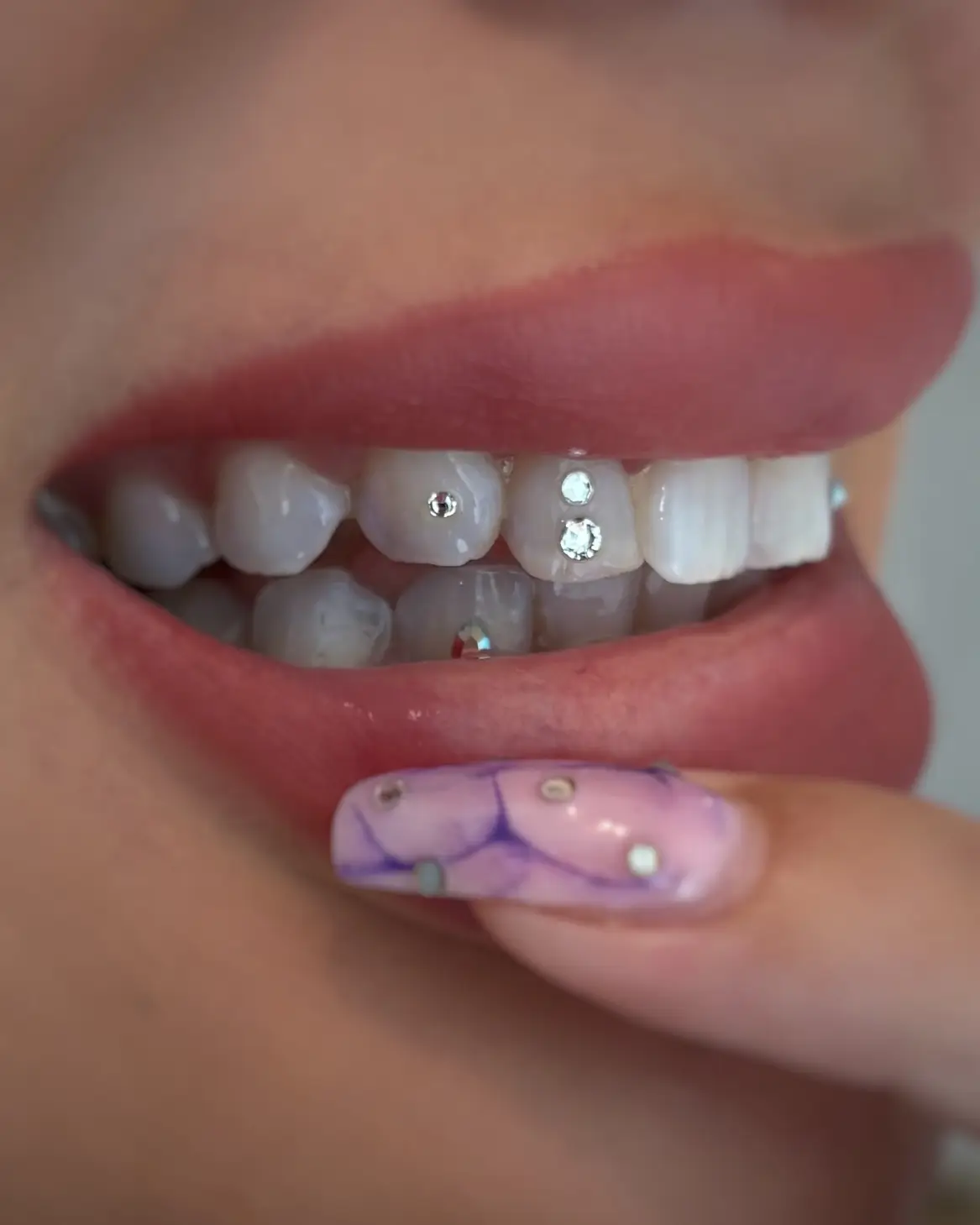 Tooth gem design med flere Swarovski tooth crystals på tænder
