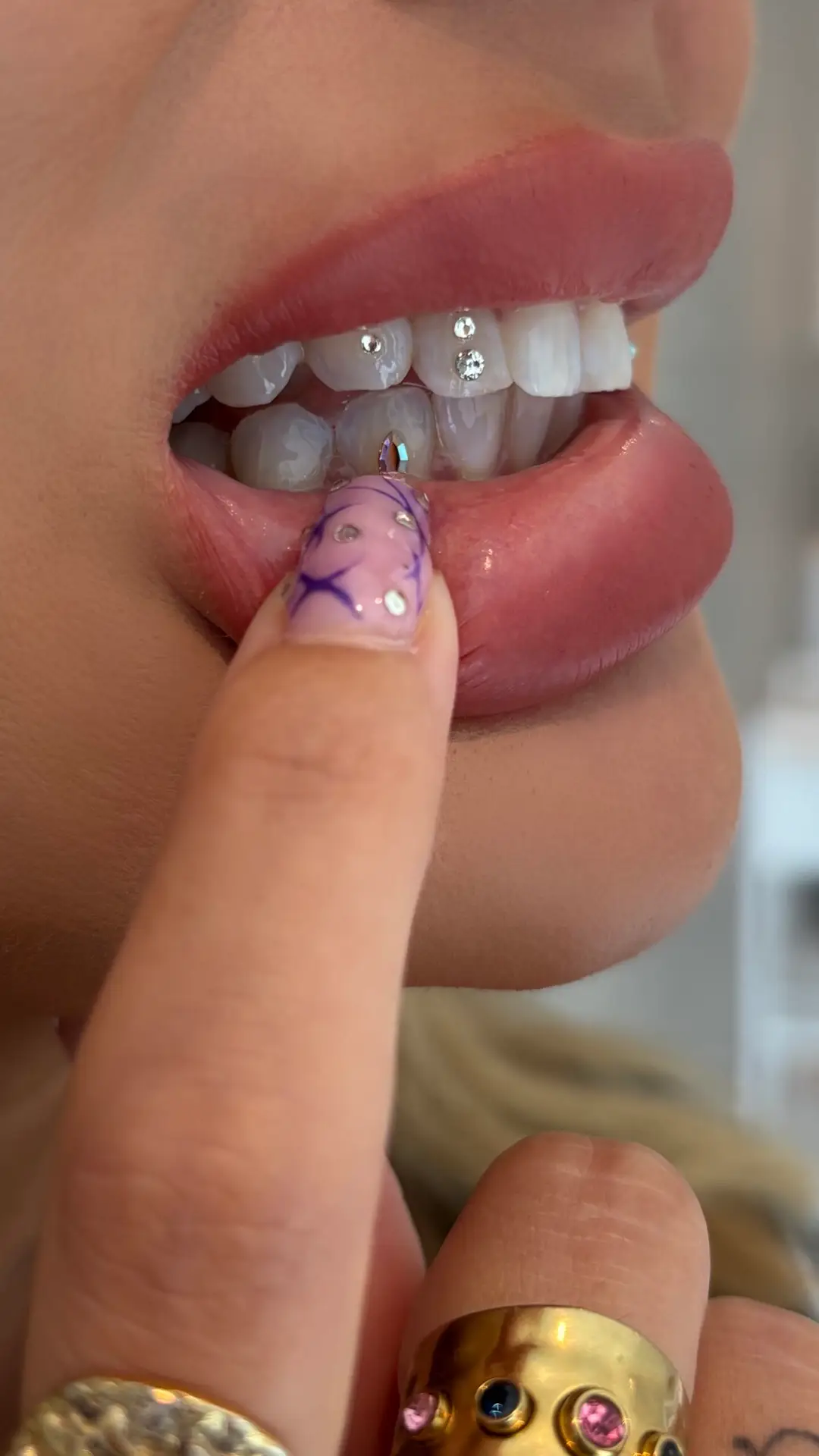 Multi tooth gems med Swarovski crystals på smil