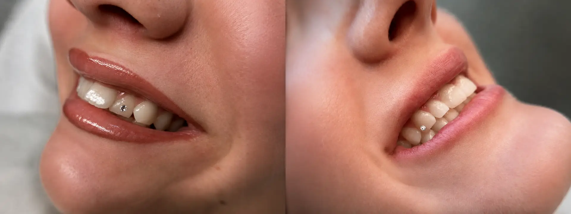 Resultat af en Single Tooth Gem lavet med en Swarovski krystal hos Brows & Beauty i Aarhus C.