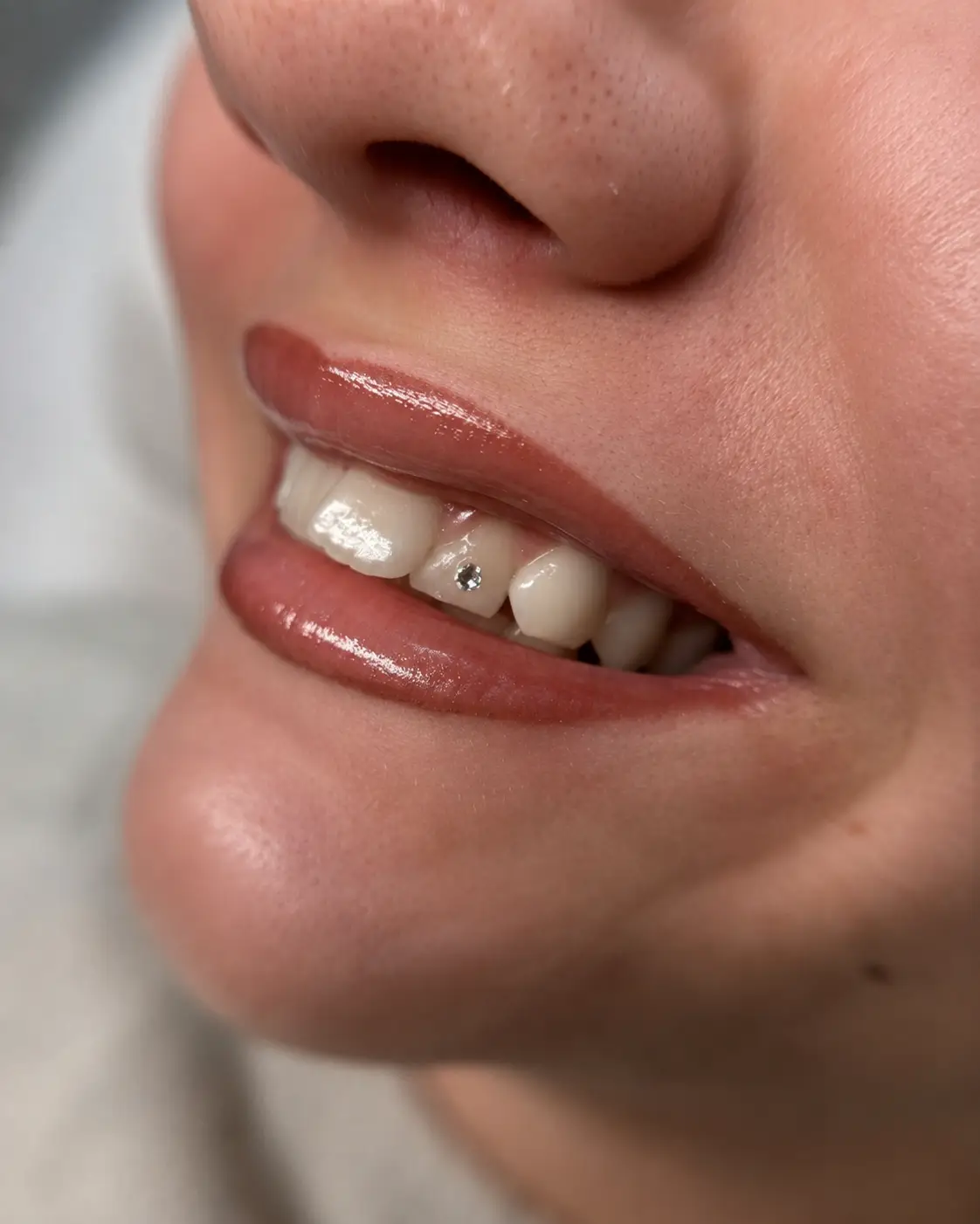 Tandsmykke og tooth gem på fortand i close-up af smil med synlig tandjuvel og naturligt resultat.