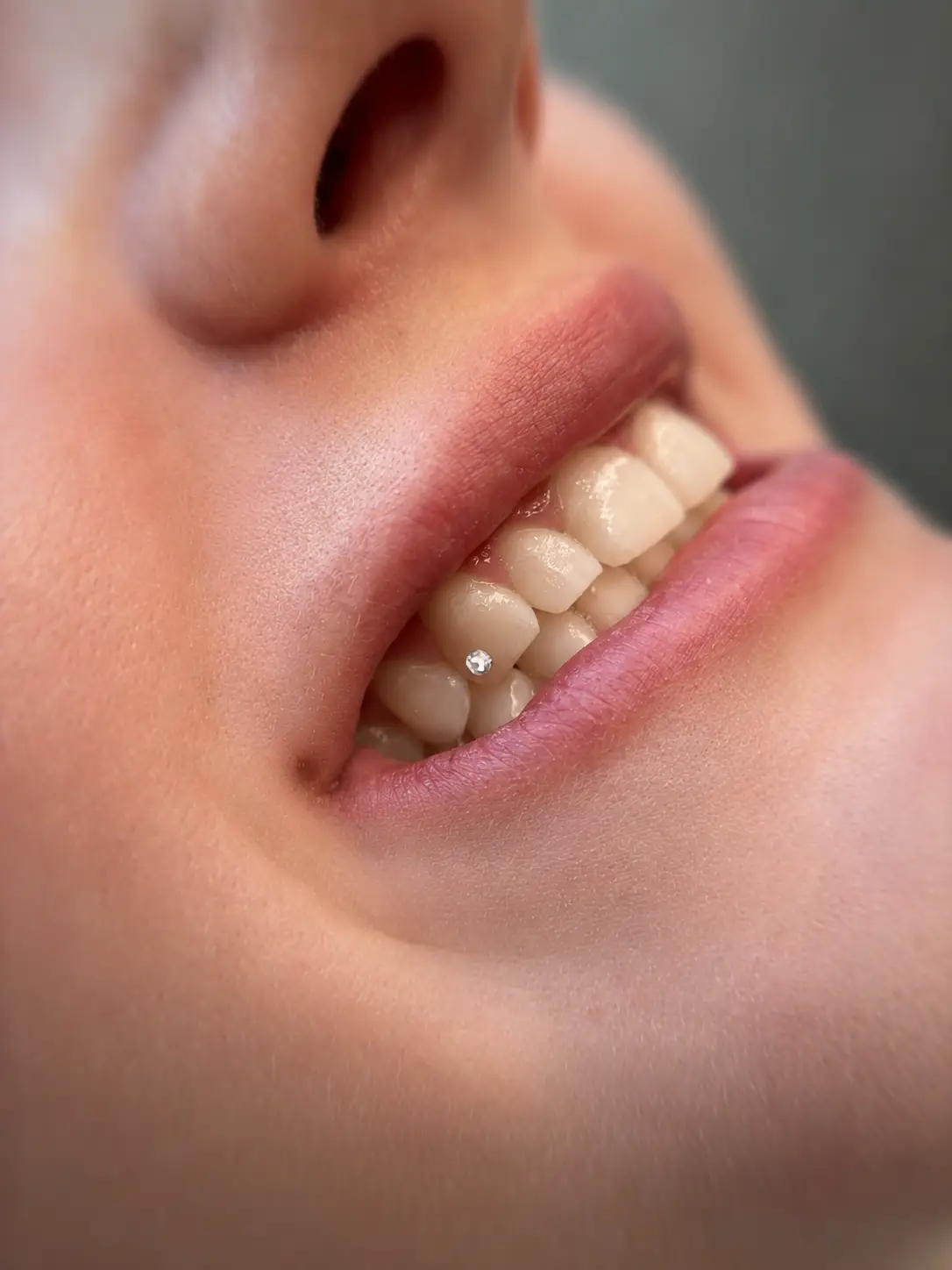 Single tooth gem tandsmykke på fortand i tæt nærbillede med synlig tandjuvel og naturlige læber.