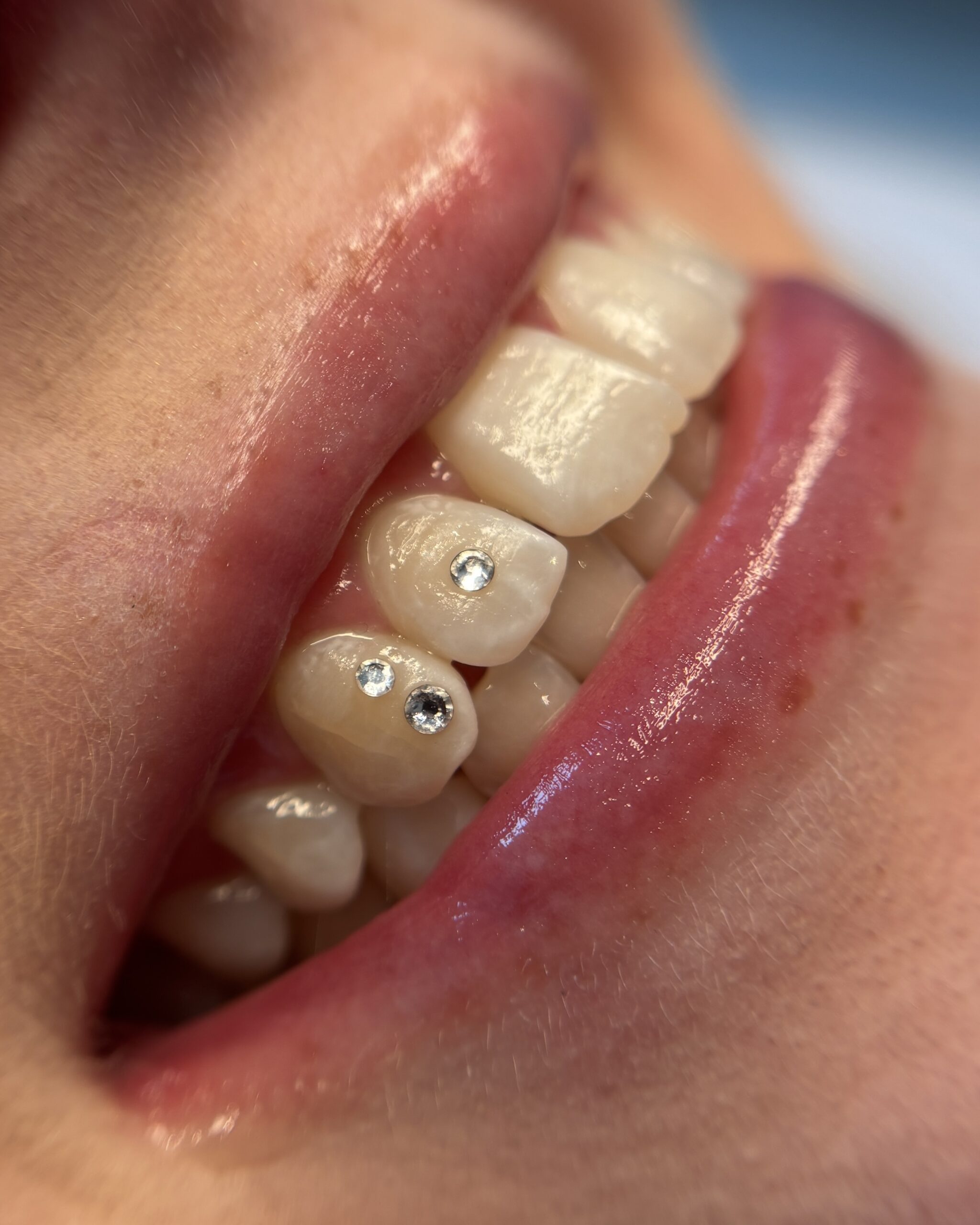 Nærbillede af tre tooth gems med skinnende krystaller på tænderne hos Brows & Beauty Aarhus