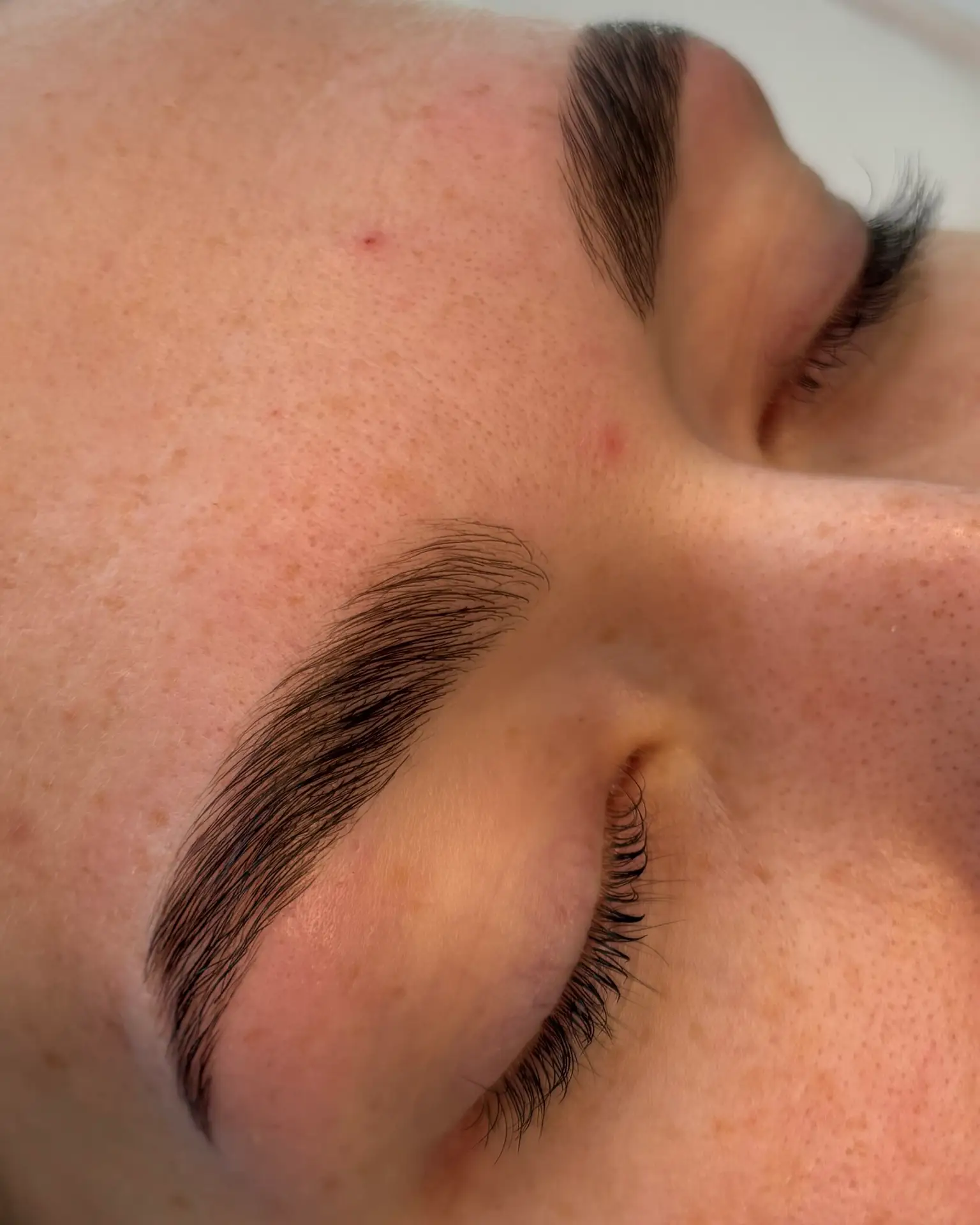 Før og efter Brow Lift behandling med fyldigere og stylede bryn i Aarhus